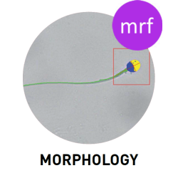 SCA Morphology