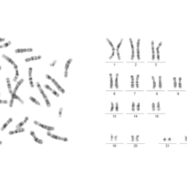 MetaClass Karyotyping